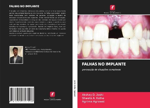 FALHAS NO IMPLANTE