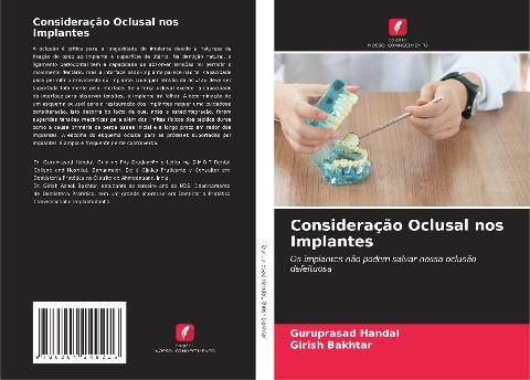 Consideração Oclusal nos Implantes