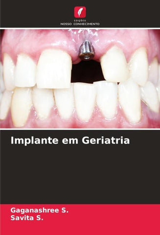 Implante em Geriatria