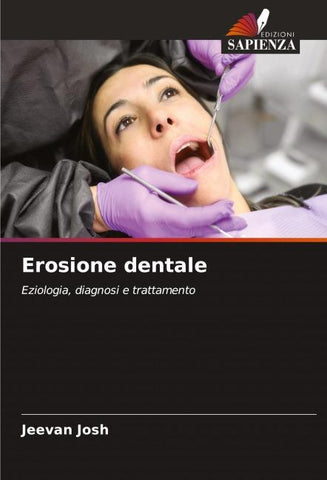 Erosione dentale