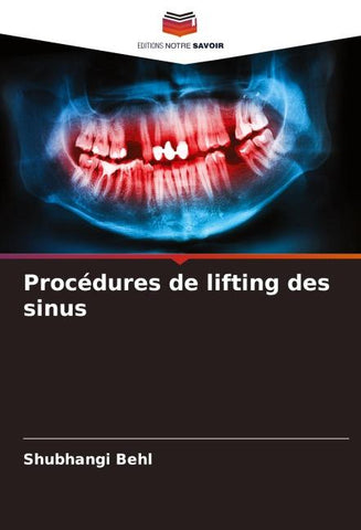 Procédures de lifting des sinus