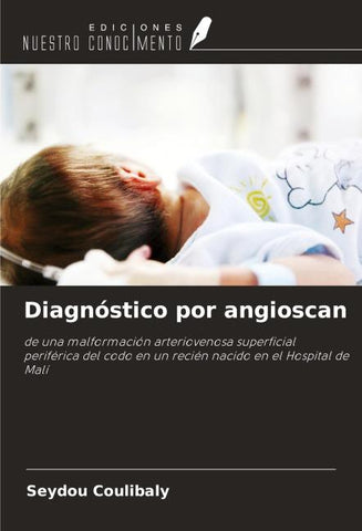 Diagnóstico por angioscan