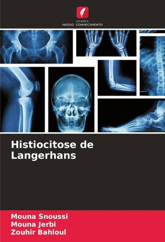Histiocitose de Langerhans