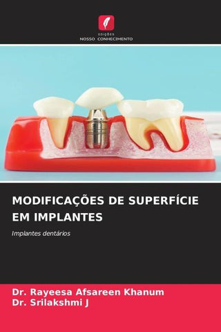MODIFICAÇÕES DE SUPERFÍCIE EM IMPLANTES