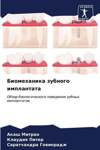 Biomehanika zubnogo implantata
