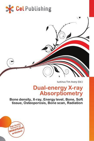 Dual-energy X-ray Absorptiometry