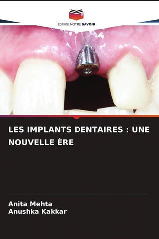 LES IMPLANTS DENTAIRES : UNE NOUVELLE ÈRE