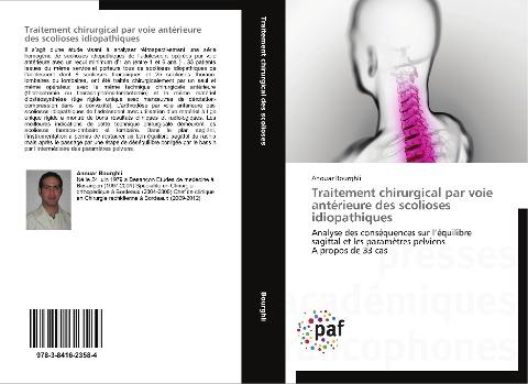 Traitement chirurgical par voie antérieure des scolioses idiopathiques