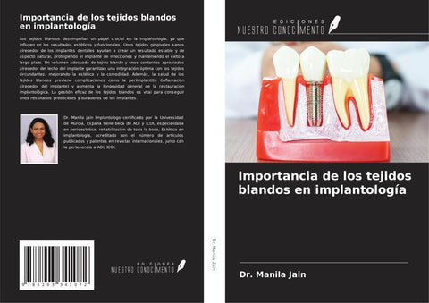 Importancia de los tejidos blandos en implantología
