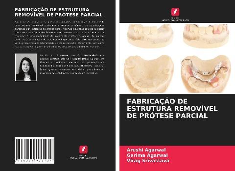 FABRICAÇÃO DE ESTRUTURA REMOVÍVEL DE PRÓTESE PARCIAL