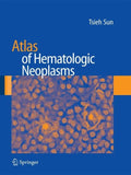 Atlas of Hematologic Neoplasms