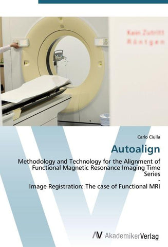 Autoalign