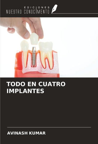 TODO EN CUATRO IMPLANTES