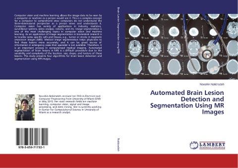 Automated Brain Lesion Detection and Segmentation Using MR Images