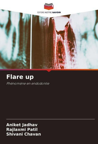 Flare up