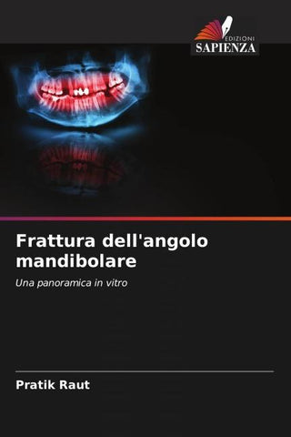 Frattura dell'angolo mandibolare