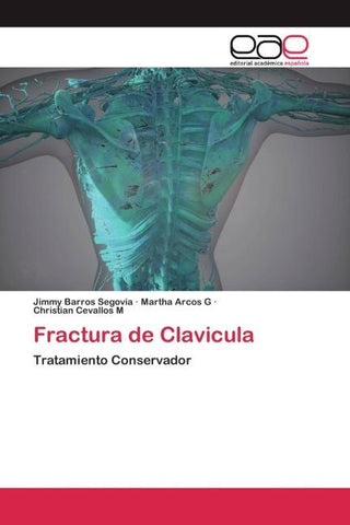 Fractura de Clavicula