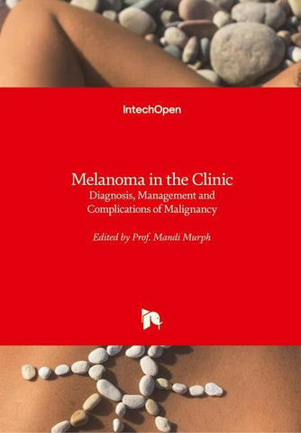 Melanoma in the Clinic