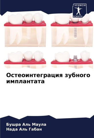 Osteointegraciq zubnogo implantata