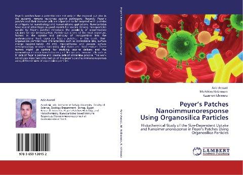 Peyer's Patches Nanoimmunoresponse Using Organosilica Particles