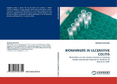 BIOMARKERS IN ULCERATIVE COLITIS