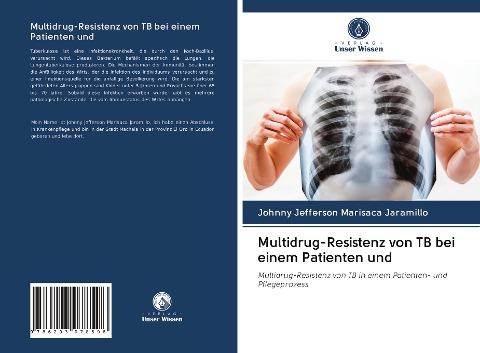 Multidrug-Resistenz von TB bei einem Patienten und