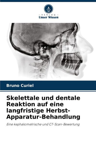 Skelettale und dentale Reaktion auf eine langfristige Herbst-Apparatur-Behandlung