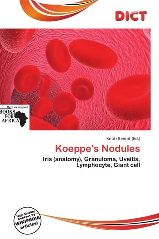 Koeppe's Nodules