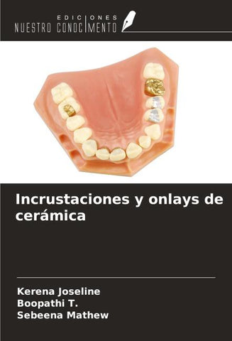 Incrustaciones y onlays de cerámica