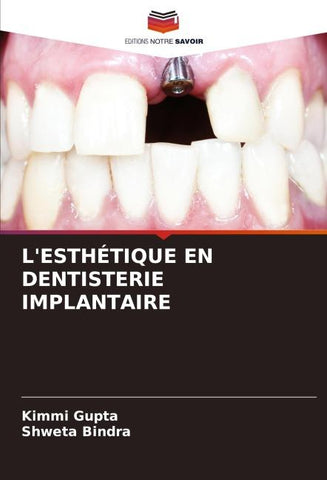 L'ESTHÉTIQUE EN DENTISTERIE IMPLANTAIRE