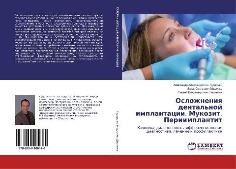 Oslozhneniq dental'noj implantacii. Mukozit. Periimplantit