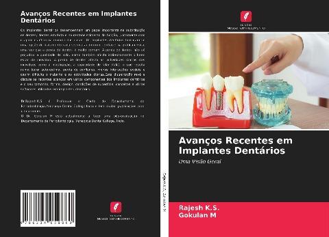 Avanços Recentes em Implantes Dentários