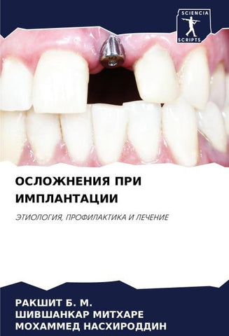 OSLOZhNENIYa PRI IMPLANTACII