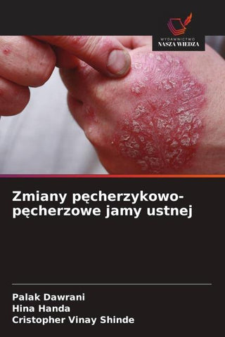 Zmiany p¿cherzykowo-p¿cherzowe jamy ustnej