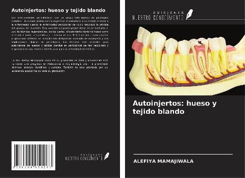 Autoinjertos: hueso y tejido blando