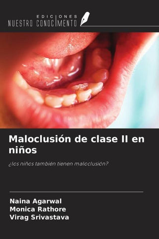 Maloclusión de clase II en niños