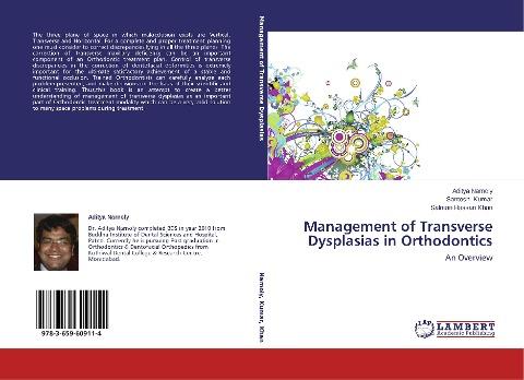 Management of Transverse Dysplasias in Orthodontics
