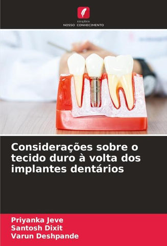 Considerações sobre o tecido duro à volta dos implantes dentários