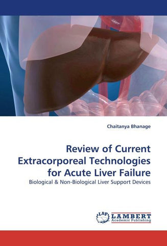 Review of Current Extracorporeal Technologies for Acute Liver Failure