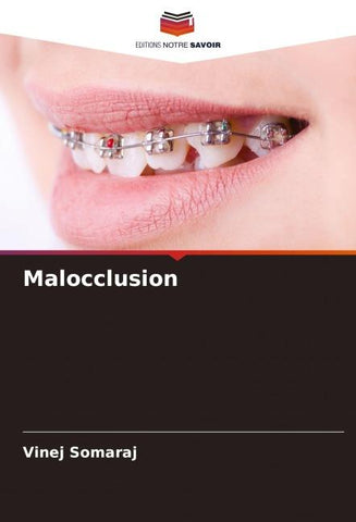 Malocclusion