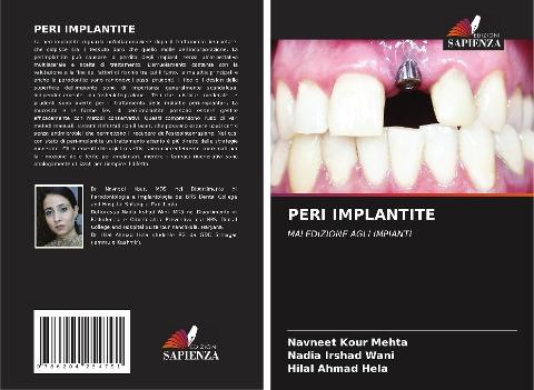 PERI IMPLANTITE