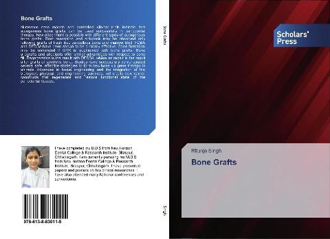 Bone Grafts