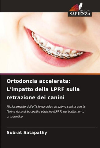 Ortodonzia accelerata: L'impatto della LPRF sulla retrazione dei canini