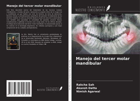 Manejo del tercer molar mandibular