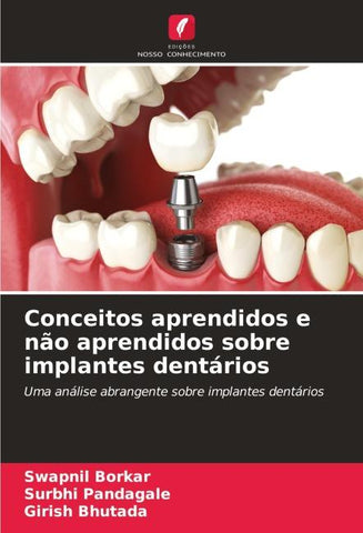 Conceitos aprendidos e não aprendidos sobre implantes dentários