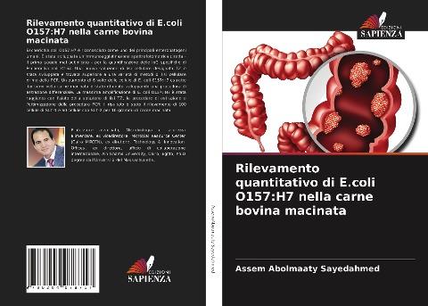 Rilevamento quantitativo di E.coli O157:H7 nella carne bovina macinata
