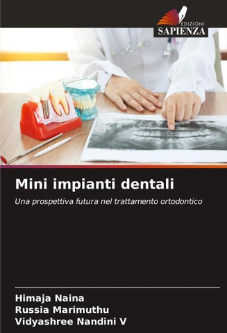 Mini impianti dentali