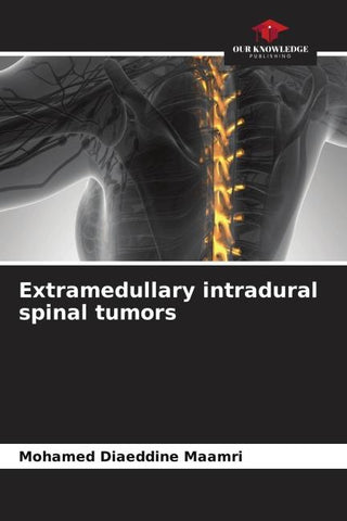 Extramedullary intradural spinal tumors