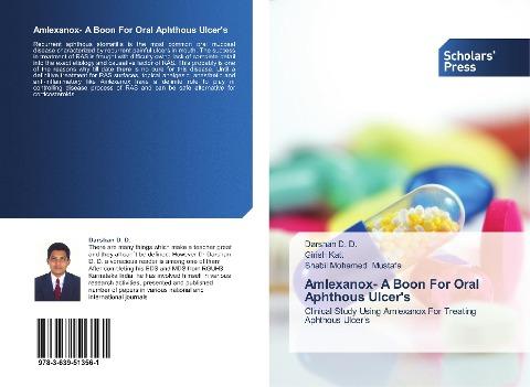 Amlexanox- A Boon For Oral Aphthous Ulcer's