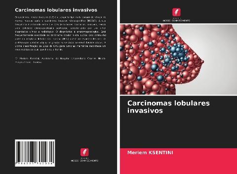 Carcinomas lobulares invasivos